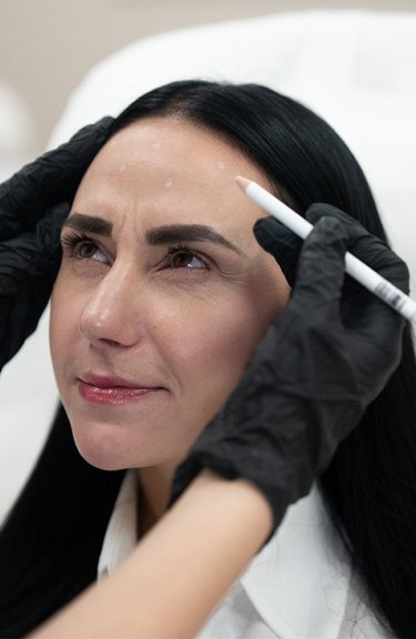 Косметолог виконує інʼєкції під час ботулінотерапії для корекції зморшок