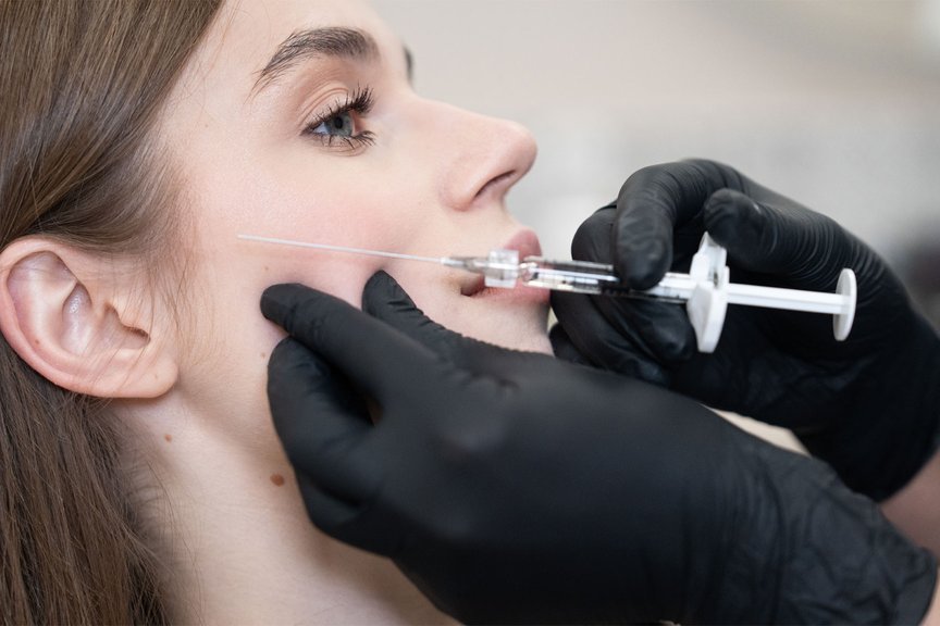 Косметолог виконує інʼєкції під час контурної пластики скул