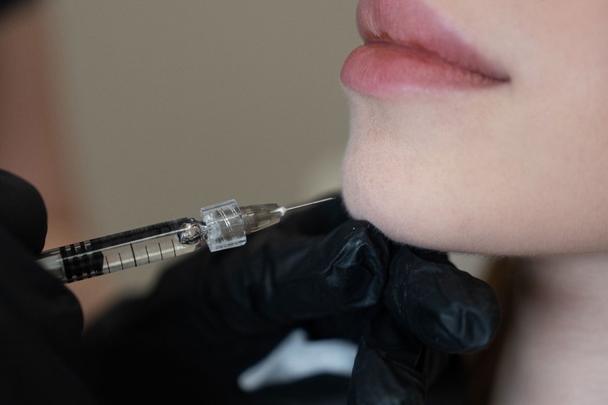 Косметолог виконує інʼєкції під час контурної пластики підборіддя