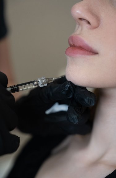 Косметолог виконує інʼєкції під час контурної пластики підборіддя