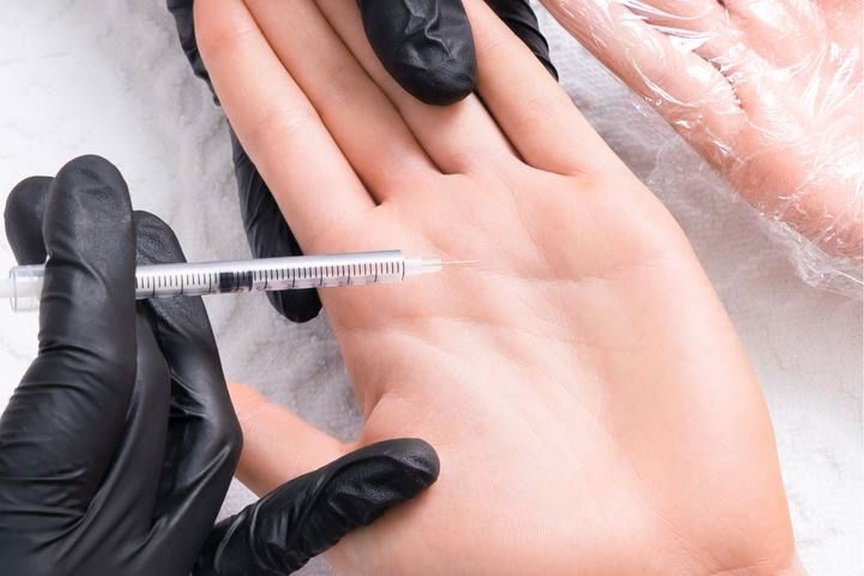 Лікування гіпергідрозу