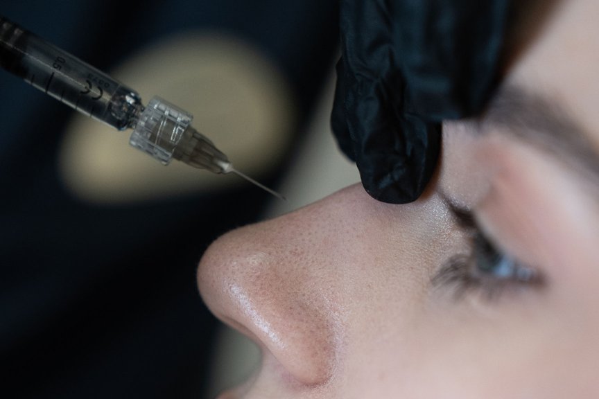 Косметолог виконує інʼєкції під час контурної пластики носа