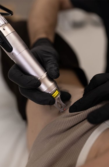 Косметолог проводить процедуру лазерного видалення татуювання