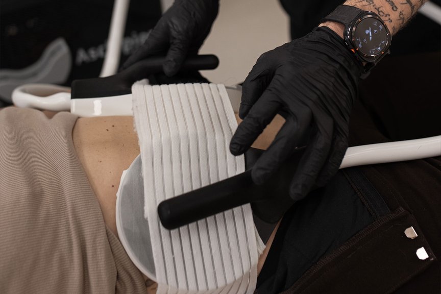 Процес апаратної процедури BodyLab — корекція контурів тіла