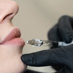 Інʼєкційна процедура для покращення форми губ