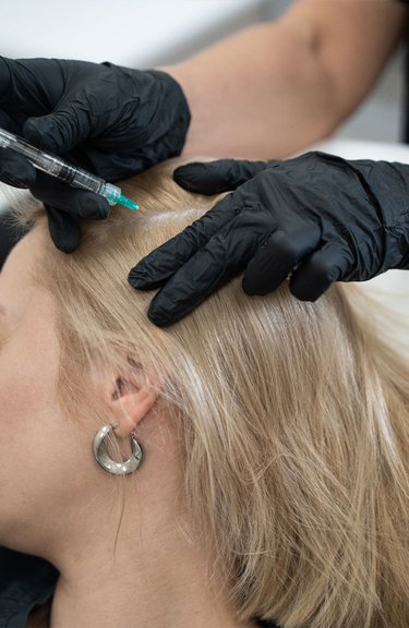 Інʼєкційна процедура для зміцнення волосяних фолікулів