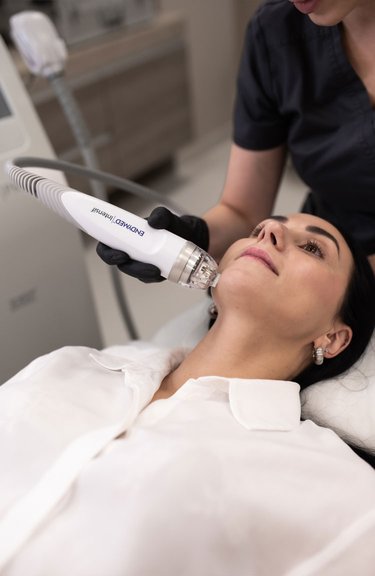 Процес омолодження шкіри за допомогою мікроголкової радіохвильової терапії