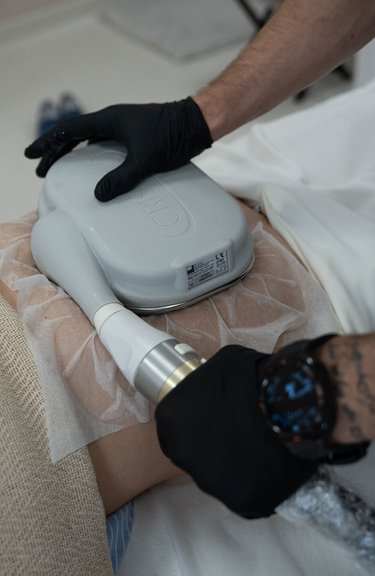 Кріоліполіз тіла — робота косметолога крупним планом