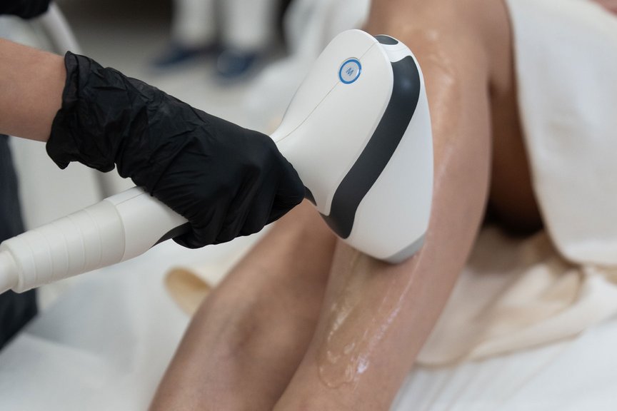 Процес лазерної епіляції шкіри — робота косметолога крупним планом
