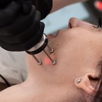 Лазерне шліфування обличчя — робота косметолога крупним планом