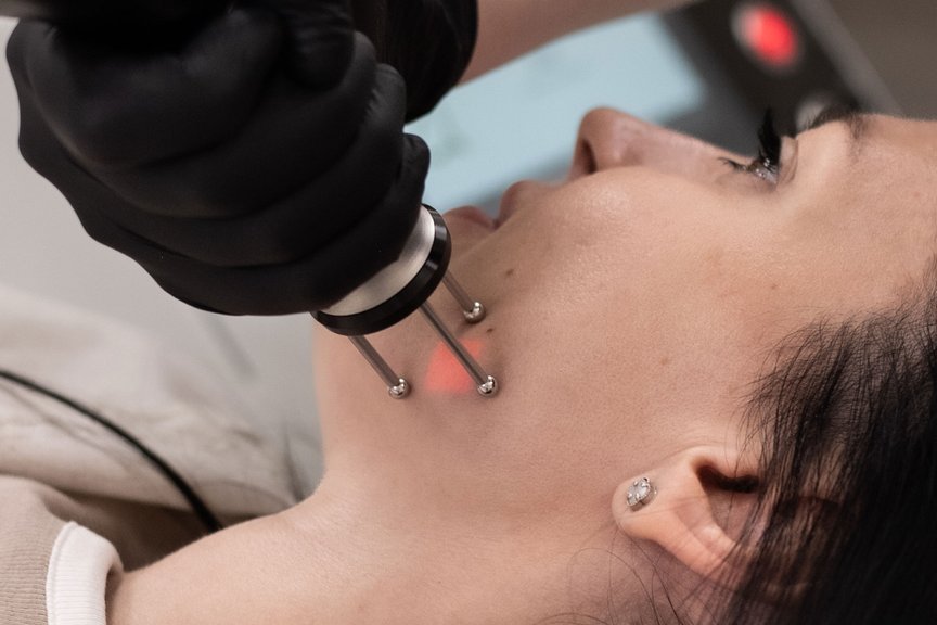 Лазерне шліфування обличчя — робота косметолога крупним планом