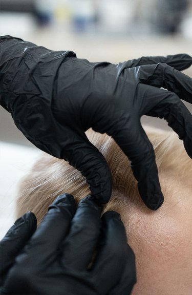 Консультація трихолога — обговорення діагностики та плану лікування