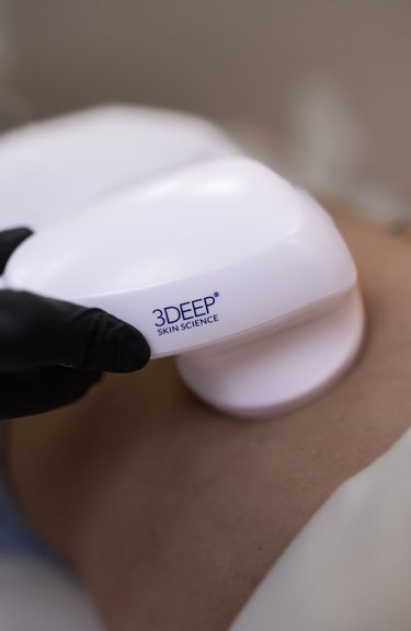 Потужний RF-ліфтинг EndyMed Pro 5